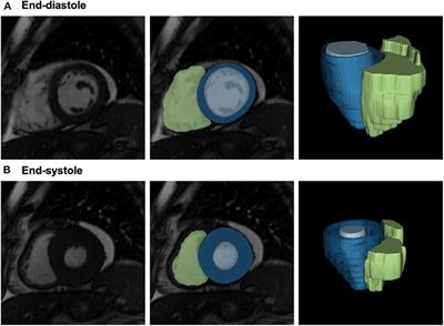 Repeatability of Cardiac Magnetic Resonance Radiomics: A Multi-Centre Multi-Vendor Test-Retest Study